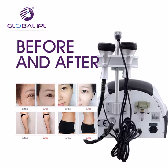 Cavitation + RF Body Slimming Machine Portable Ultrasound Slimming with 3 in 1 Device