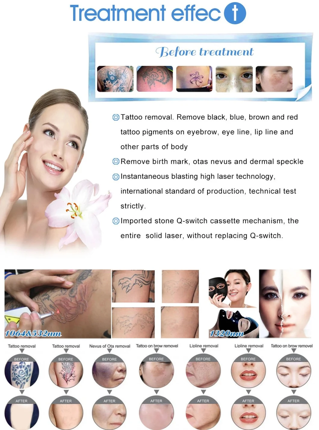 Beauty Laser Treatment Equipment Q Switched ND YAG Laser Pico Pigment Tattoo Removal Machine